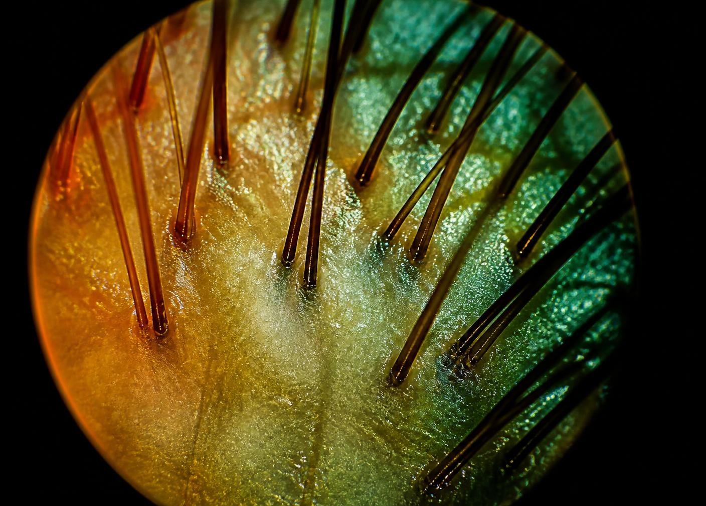 ScalpFIT™ magnified view of scalp and follicles